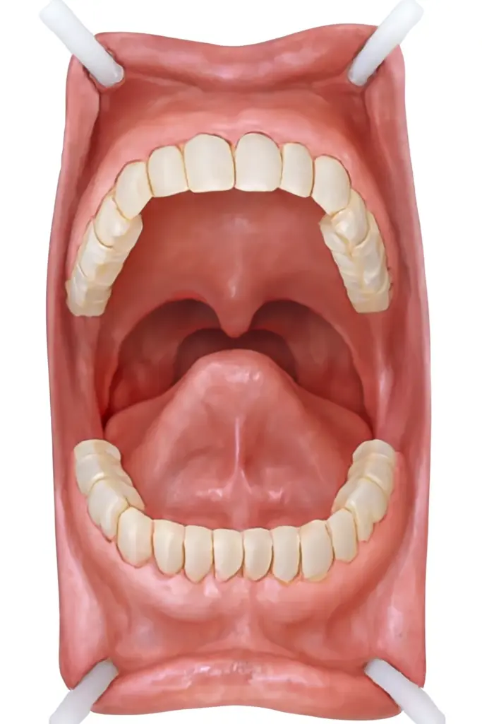 impacto del surco alveolar en un habla clara