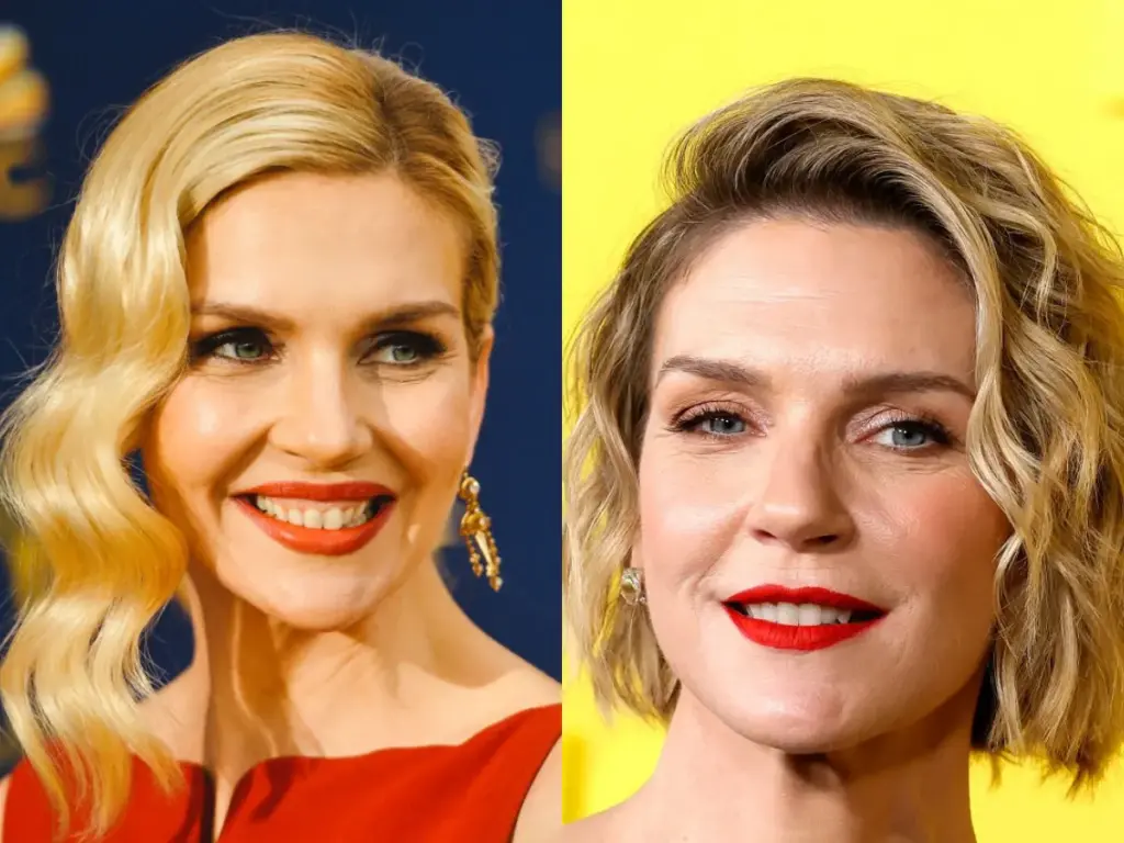 rhea-seehorn-teeth-before-after