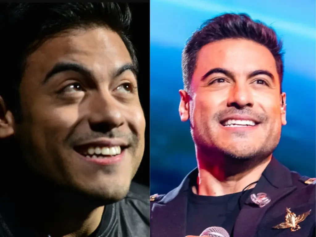 carlos-rivera-teeth-before-after
