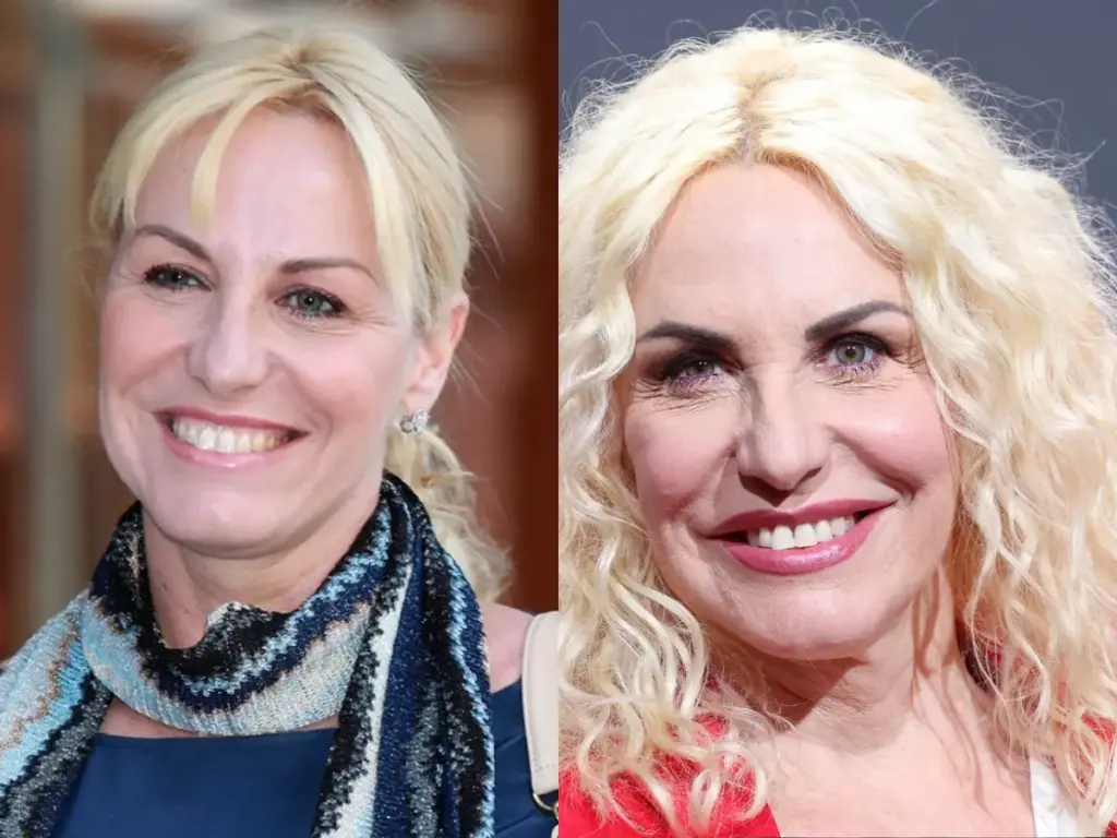 antonella clerici tanden voor en na