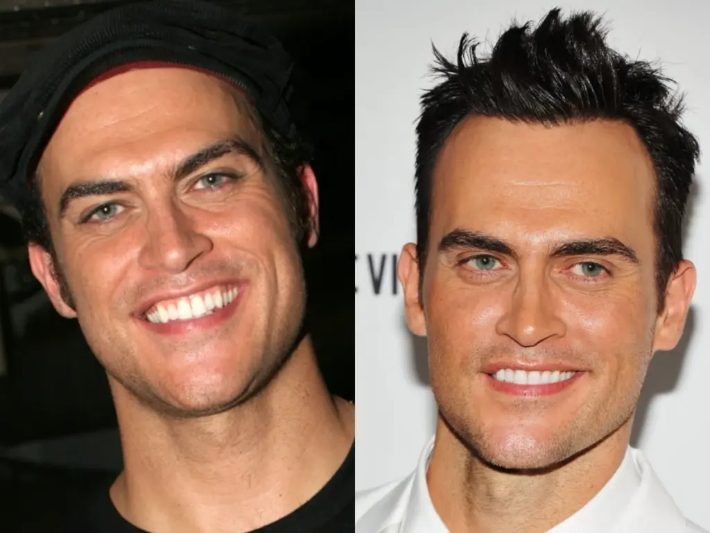 cheyenne jackson before after