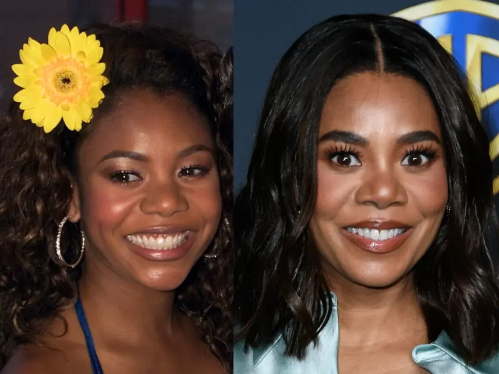 regina-hall-teeth-before-after