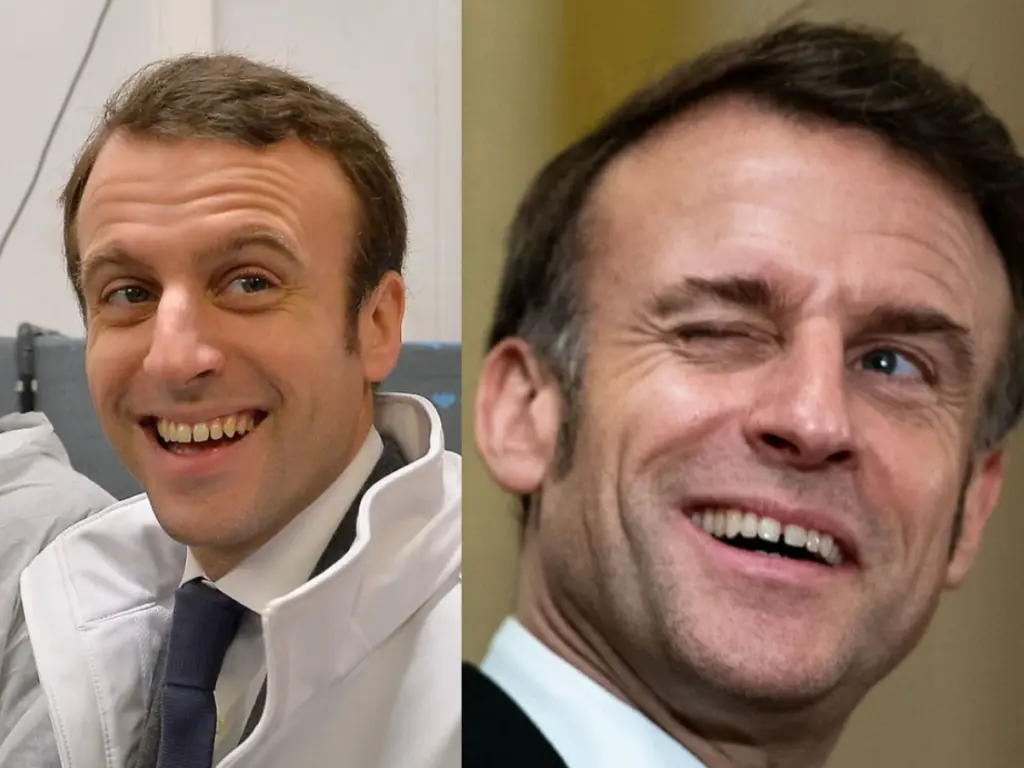 emmanuel-macron-teeth-before-after