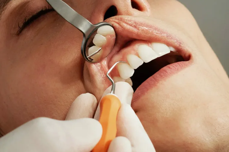 dental-code-d4921