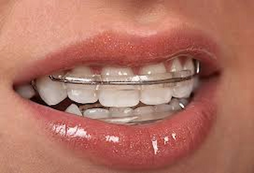 dental code d8699