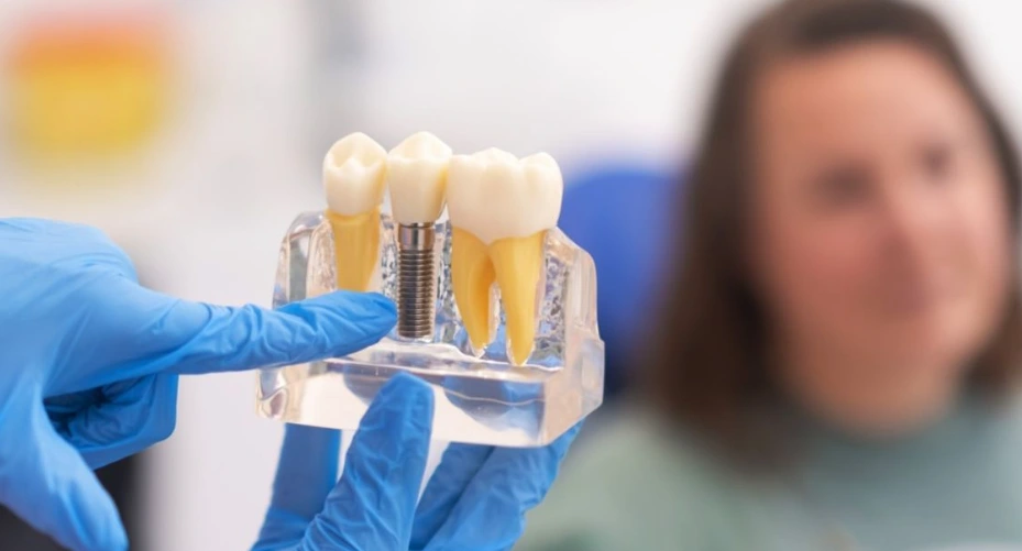 dental-implant-code-d7510