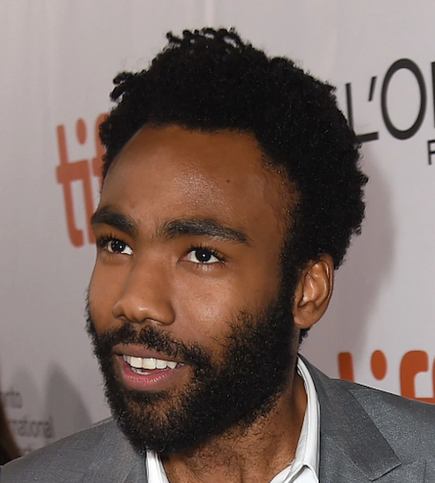 donald glover teeth 2015