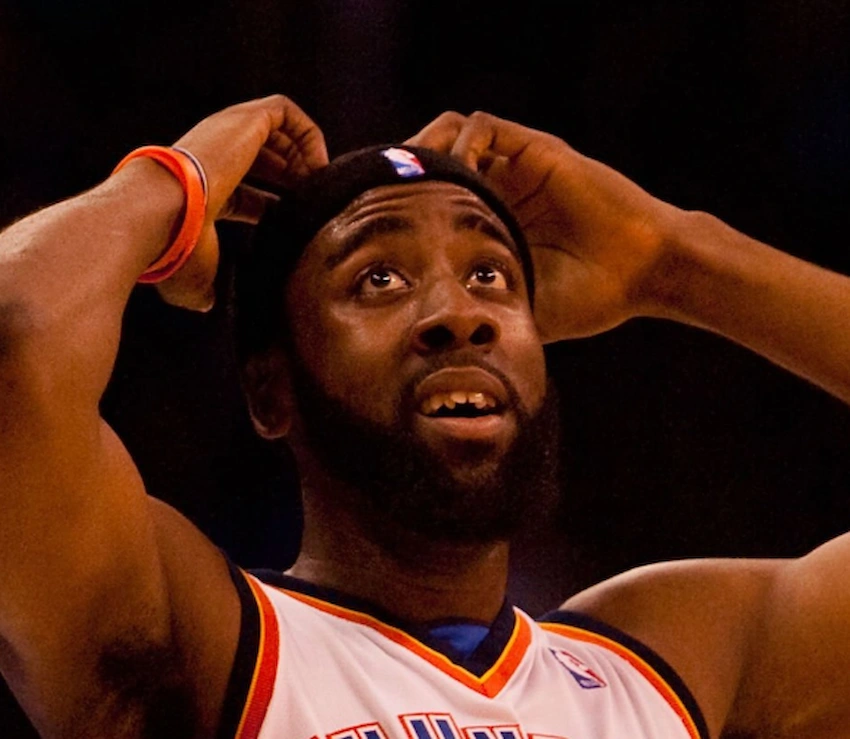 james harden teeth 2010
