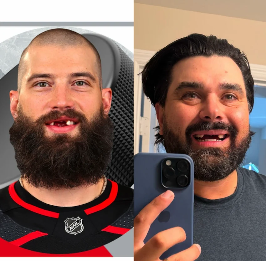 joey coldcuts teeth 2025 before