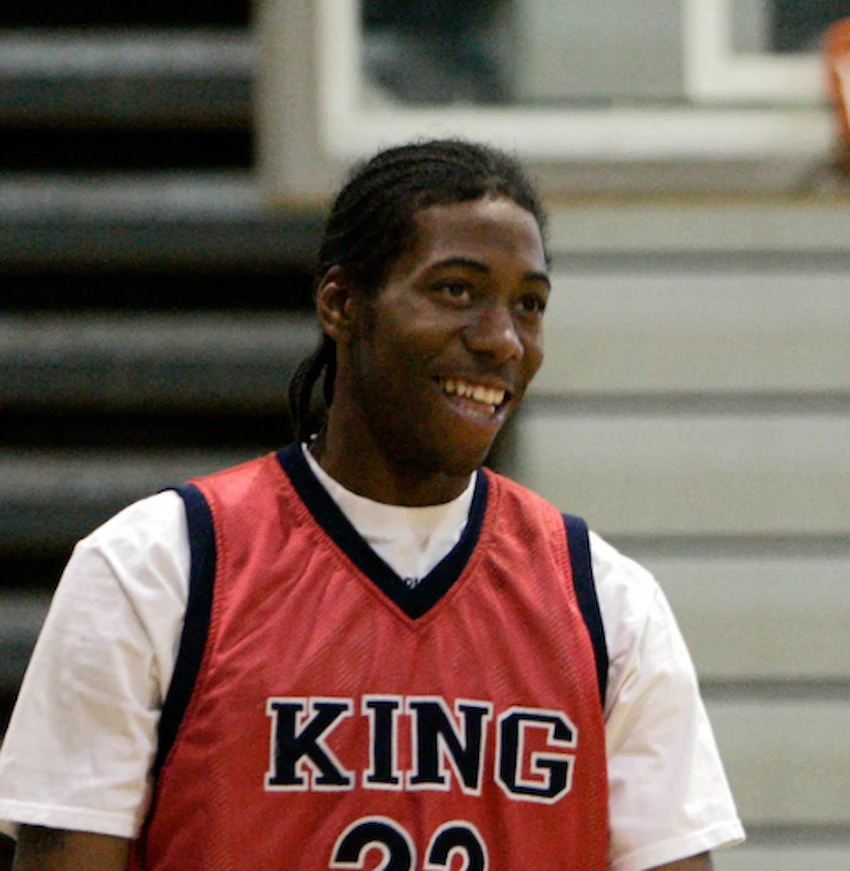 kawhi leonard teeth 2009