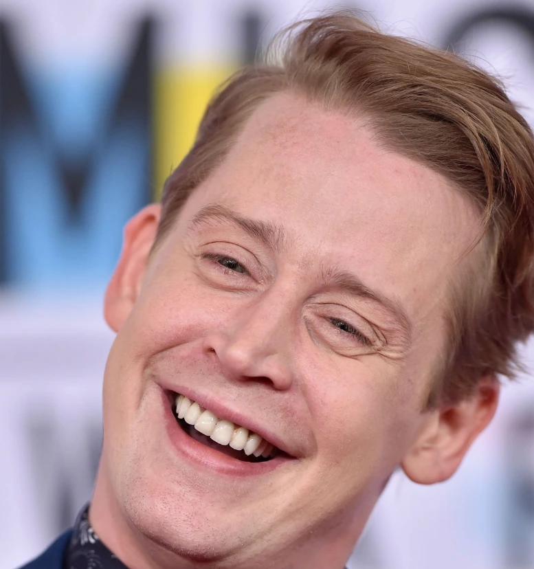 dientes de macaulay culkin en 2018