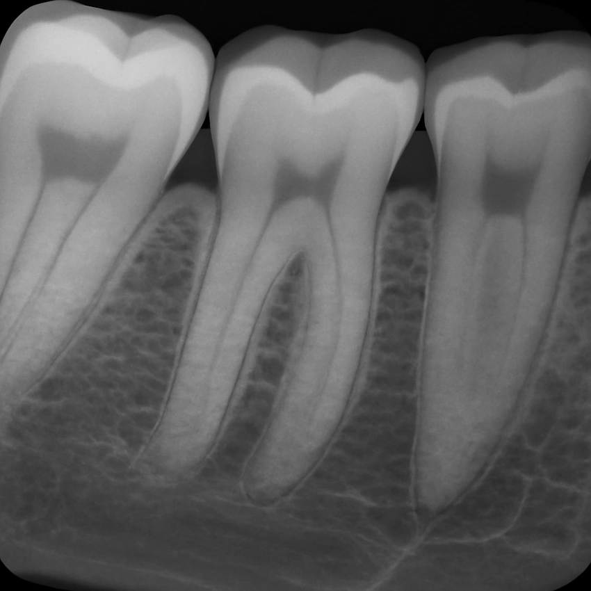 puntos principales del rendimiento d0389