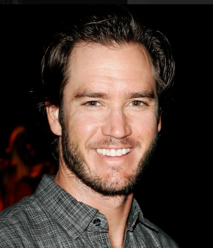 mark paul gosselaar teeth 2010