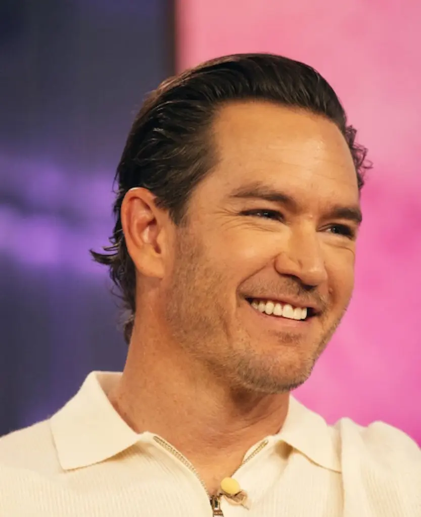mark paul gosselaar teeth 2025