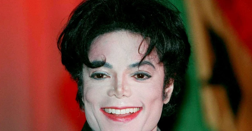 dientes de Michael Jackson en 1995