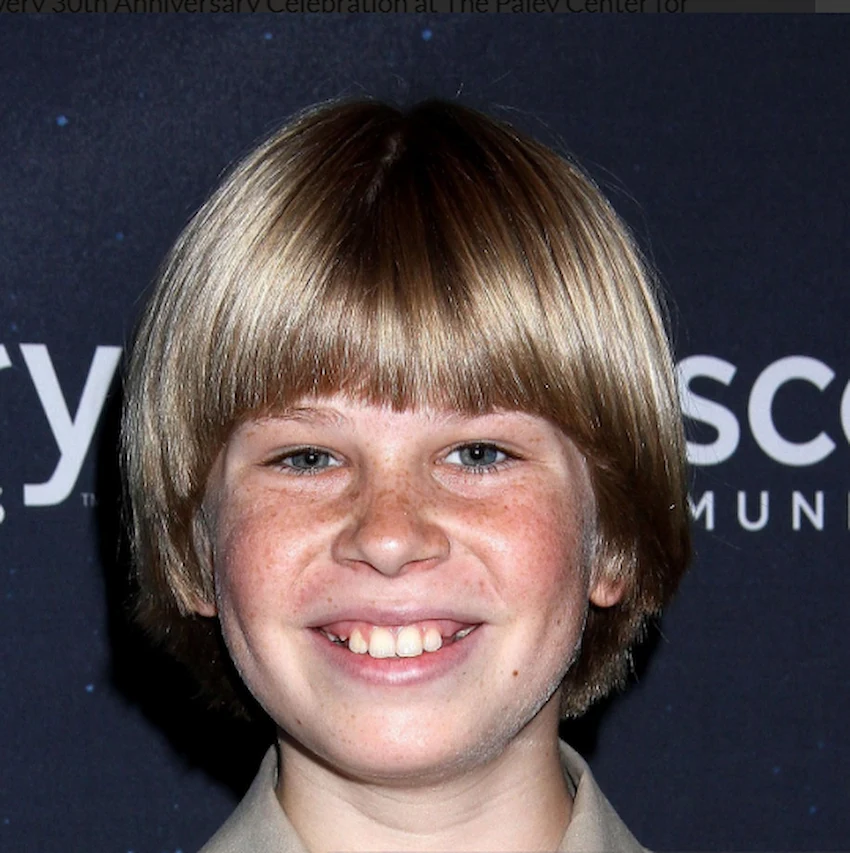robert irwin teeth 2015