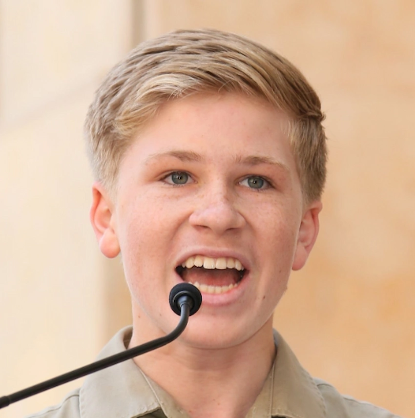 robert irwin teeth 2018