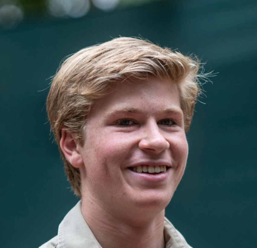robert irwin teeth 2020