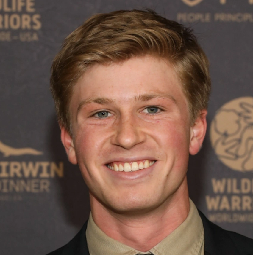 robert irwin teeth 2023