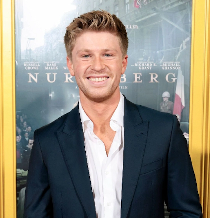 robert irwin teeth 2025