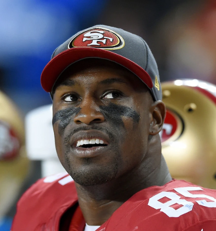 vernon davis teeth 2015