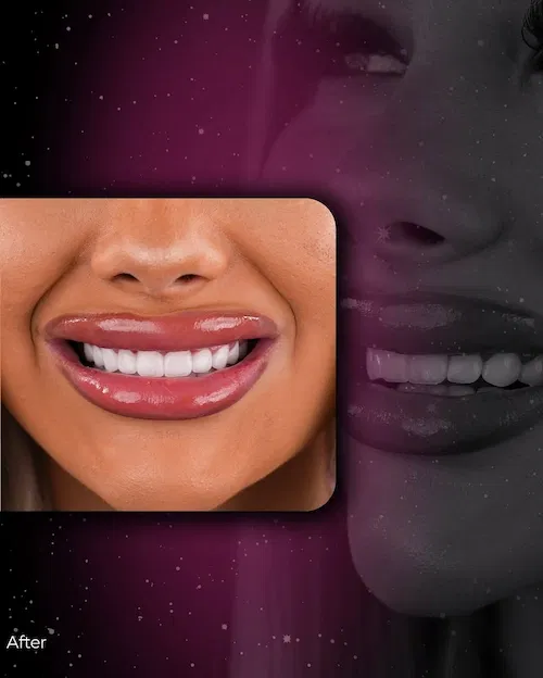 At Lema Dental Clinic we design not only your smile but also your comfort a seamless experien 4