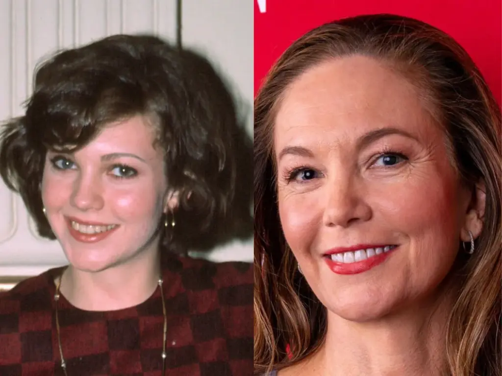 diane-lane-teeth-before-after