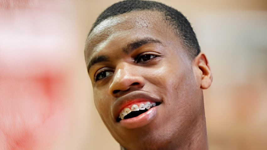 buddy hield teeth 2013