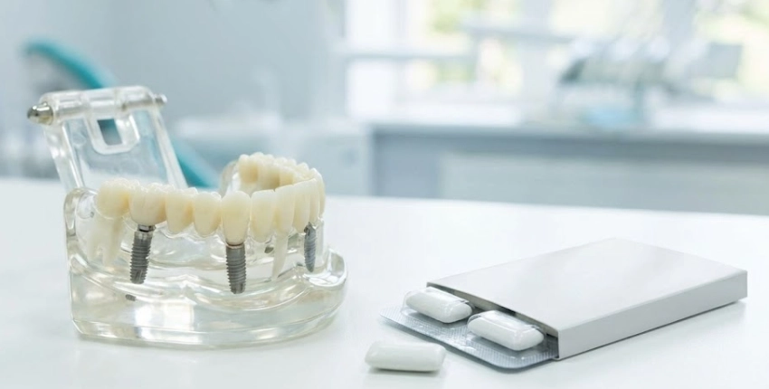 can you chew gum with all on 4 implants