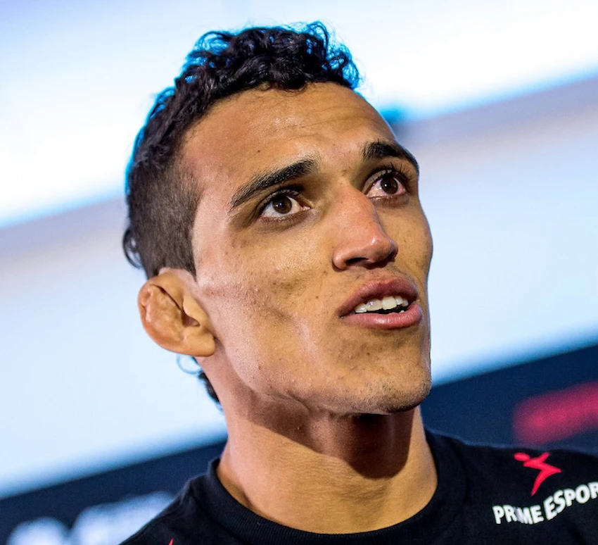 charles oliveira teeth 2015