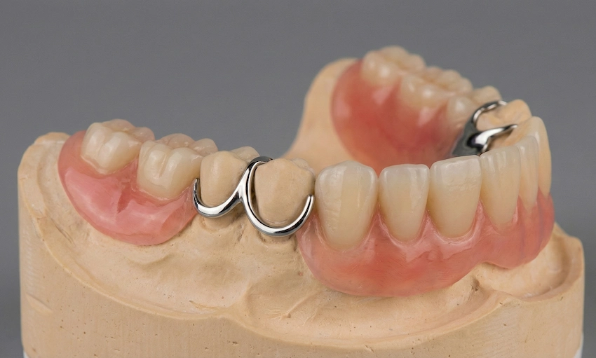 tandmünt