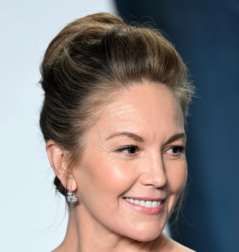 diane lane teeth in 2022