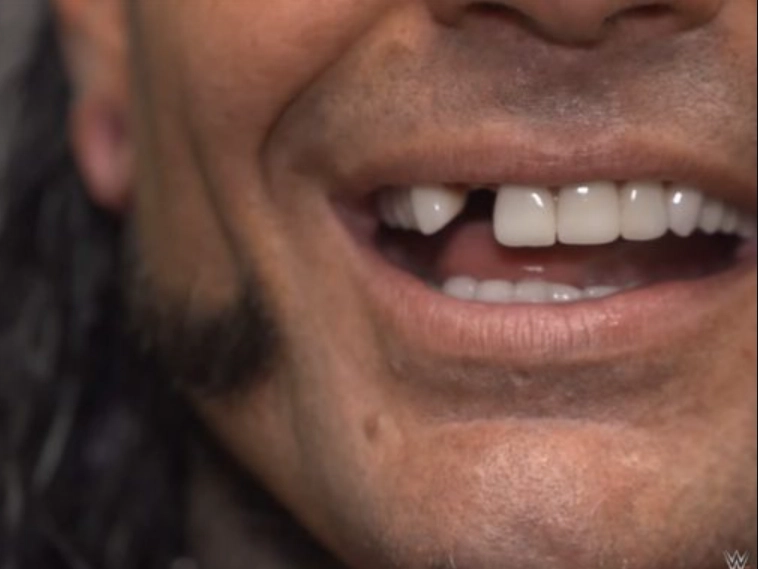 jeff hardy injury