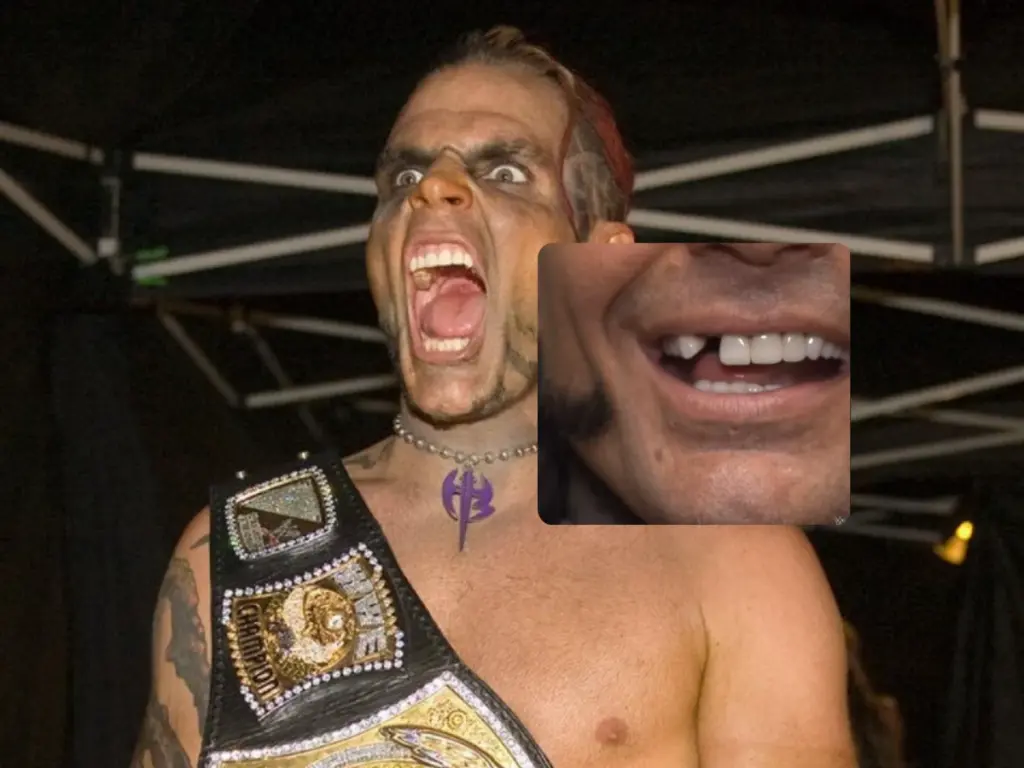 jeff hardy tooth loss