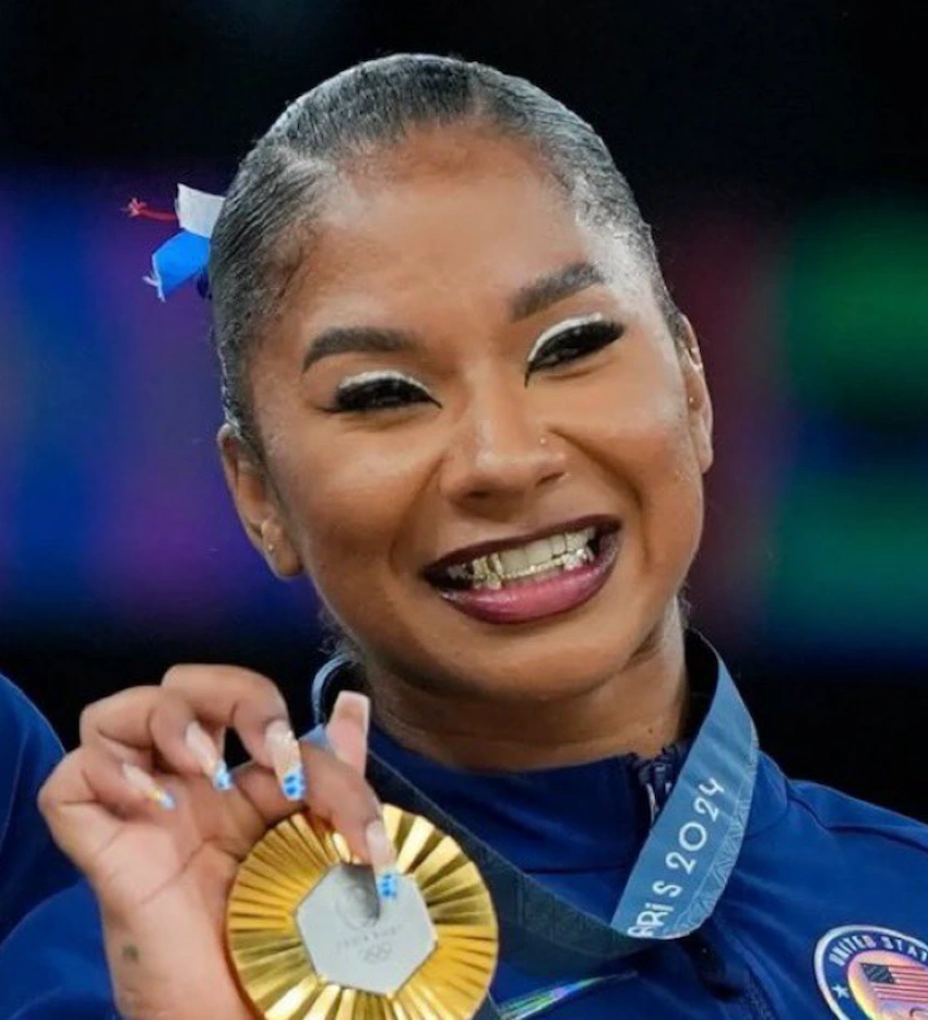 jordan chiles teeth 2024