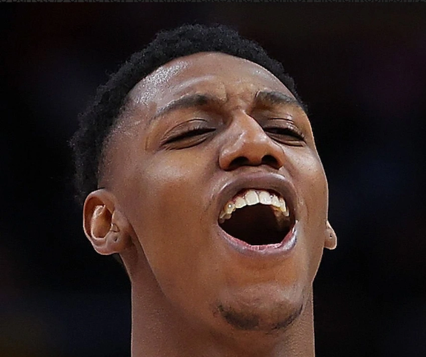 rj barrett teeth 2022