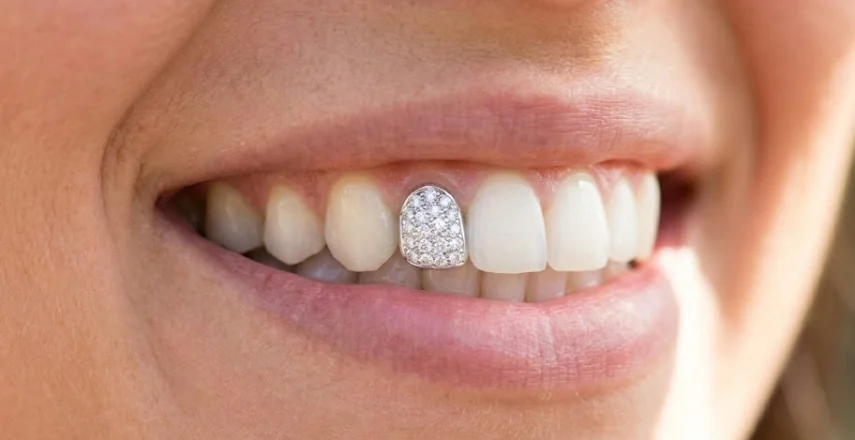a-brilliant-long-lasting-smile-accessory
