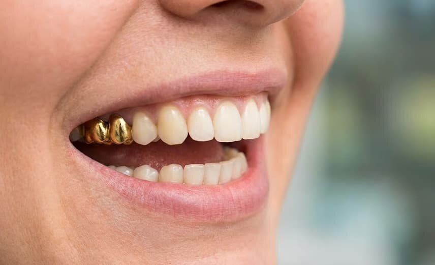 a-confident-golden-smile
