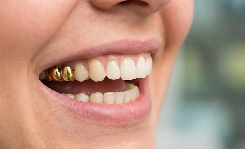 a-confident-golden-smile