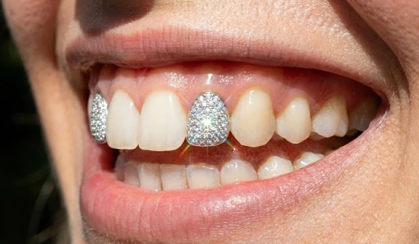 ένας-λαμπερός-κρύσταλλος-swarovski-σε-υγιές-χαμόγελο