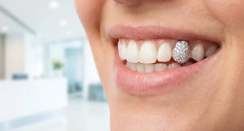 ابتسامة مشرقة بتاج ماسي