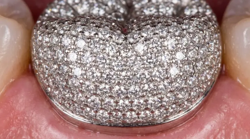 aesthetic-diamond-with-potential-risks