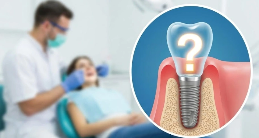anatomy-of-a-dental-implant