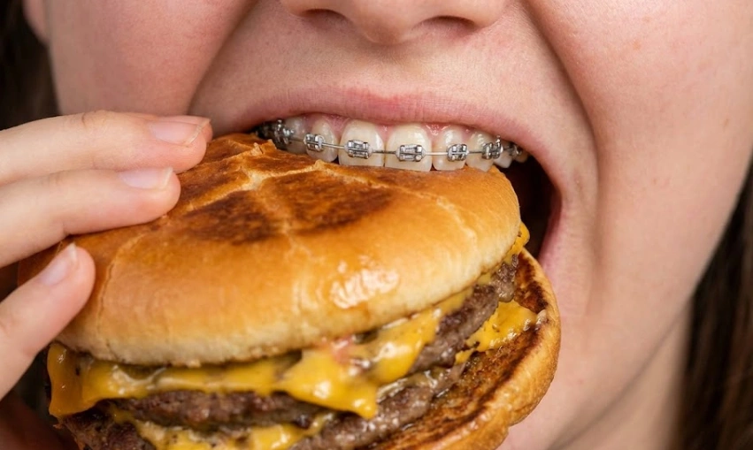 biting a burger risks broken brackets
