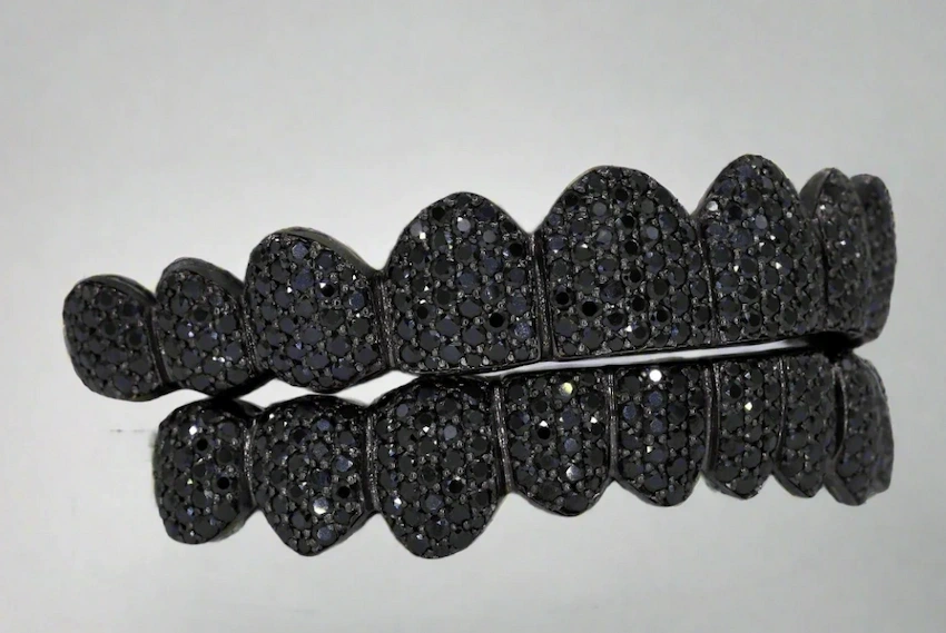 black diamond for teeth at lema dental clinic