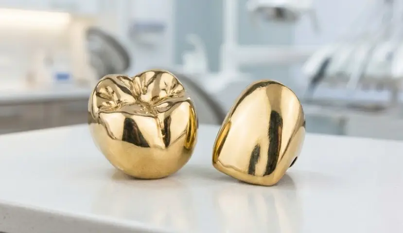 coronas dentales de oro pulido hechas a medida