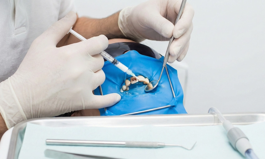 dark after a root canal