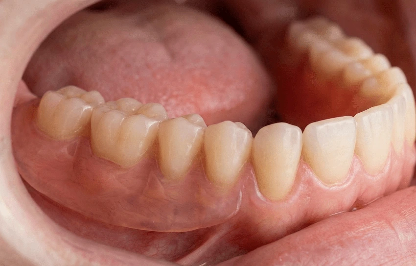 deflex painduv hambumus patsiilitill