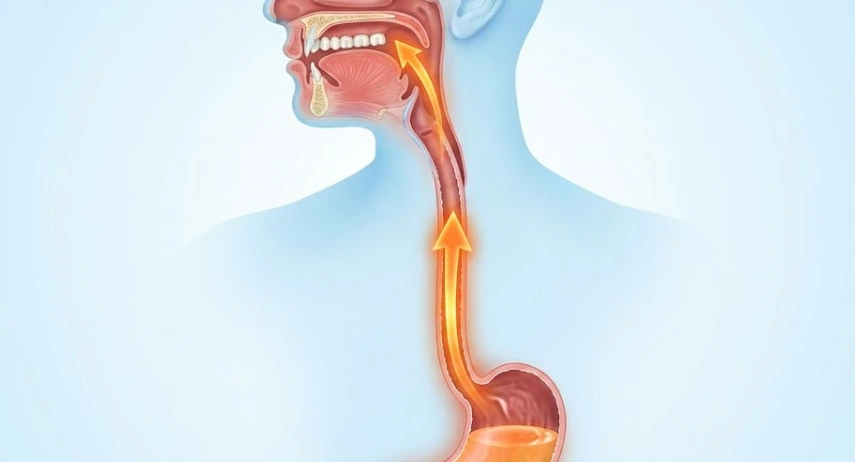 diagram-showing-stomach-acid-reflux