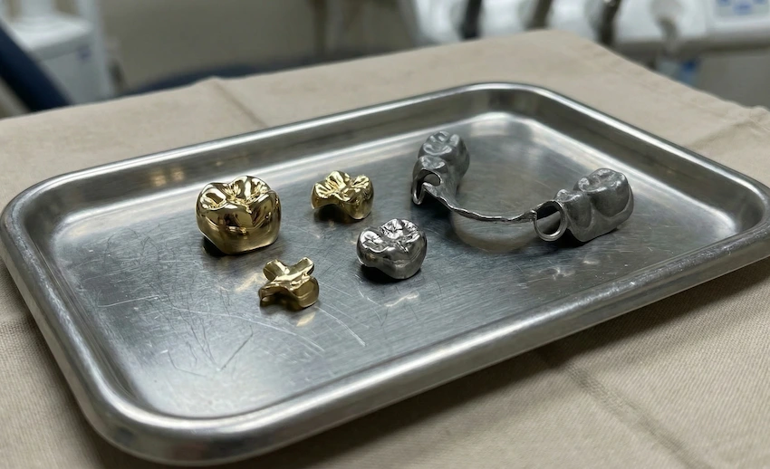 restauraciones de oro en turquía